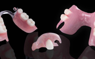 Выбор зубных протезов при частичном отсутствии зубов