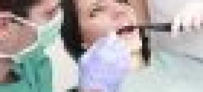 Симптомы и лечение воспаления надкостницы зуба