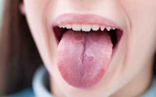Диагностика заболеваний человека по языку