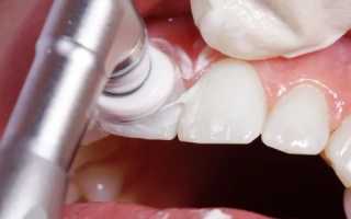 Чистка зубов вред и польза
