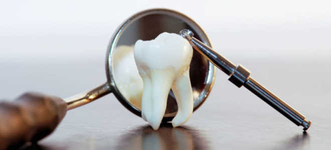 Ретинированный зуб дистопированный