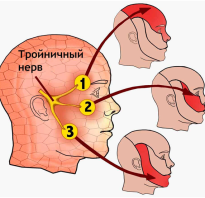Тройничный нерв симптомы и лечение