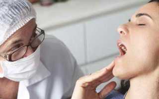 Как лечить стоматит у беременной во рту
