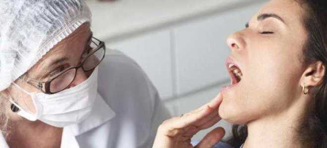 Чем лечить стоматит при беременности