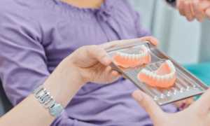 Как ухаживать за съемными зубными протезами в домашних условиях