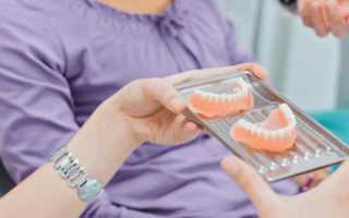 Как ухаживать за съемными зубными протезами в домашних условиях
