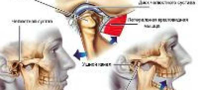 Болит нижняя челюсть