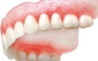 Как привыкнуть к зубным протезам съемным