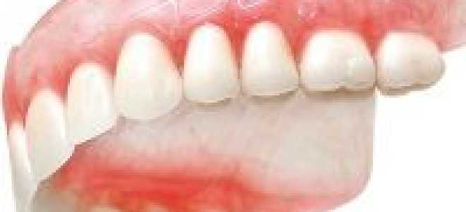 Как привыкнуть к зубным протезам съемным