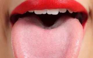 Заболевания полости рта и языка