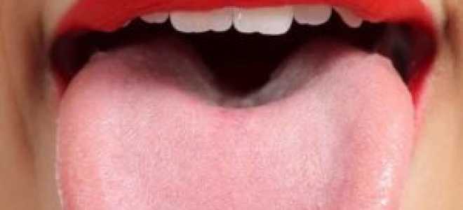 Заболевания полости рта и языка