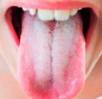 Белый налет на языке у взрослых причины лечение