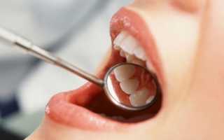 Что такое гранулема корня зуба и как ее вылечить