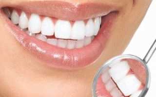 Кислородное отбеливание зубов