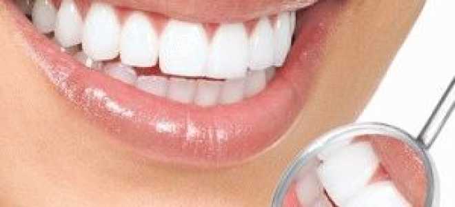 Кислородное отбеливание зубов