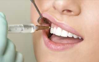 Можно ли вылечить кисту зуба без удаления