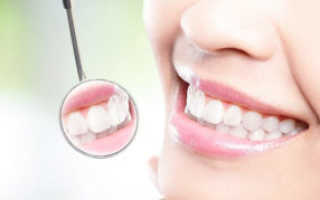 Что такое пародонтит зубов