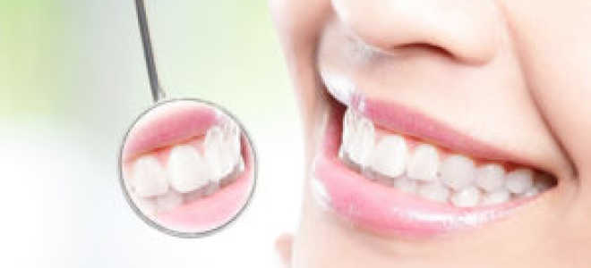 Что такое пародонтит зубов