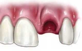 Что такое альвеолы зубов и где они находятся