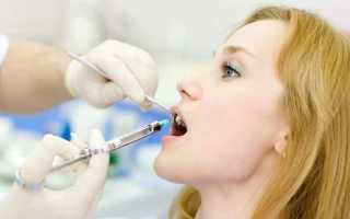 Сколько по времени отходит анестезия зуба