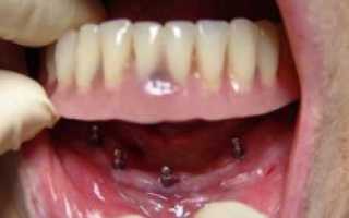 Врач стоматолог ортопед что лечит