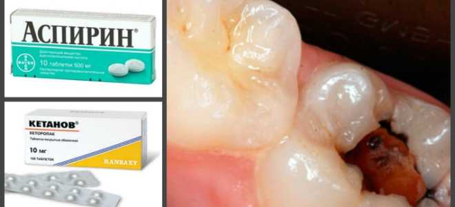 Зубная боль что делать в домашних условиях