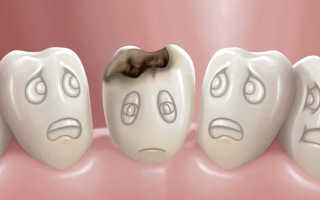 Белые пятна на зубах у взрослых