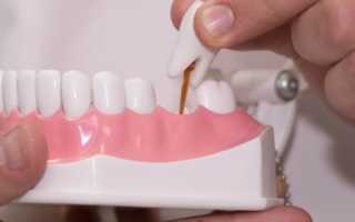 Классификация методик протезирования зубов