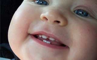 Температура при прорезывании зубов у детей
