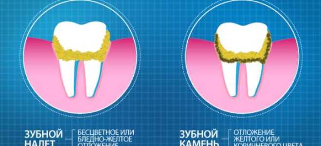 Флоссы для чистки зубов