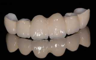Какие бывают коронки на зубы