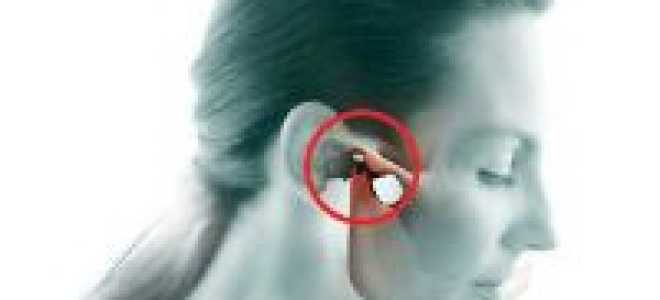 Дисфункция челюстного сустава симптомы лечение