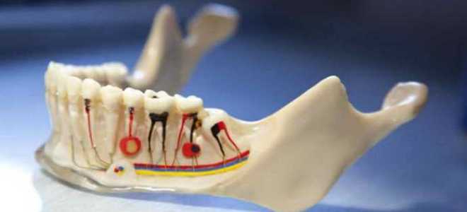 Как распломбировать гуттаперчу