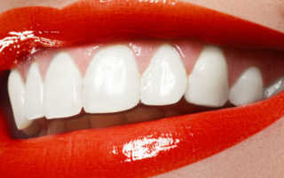 Сколько стоит отбеливание зубов у стоматолога и на дому