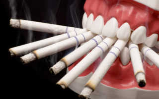 Через сколько можно курить после удаления зуба