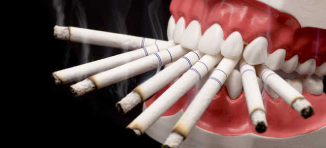 После удаления зуба можно курить