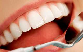 Как самостоятельно отбелить зубы в домашних условиях