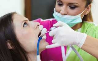 Лечение зубов при беременности во втором триместре