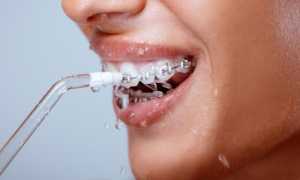 Ирригаторы для чистки зубов и полости рта