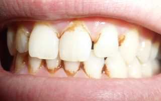 Средство от пятен на зубах