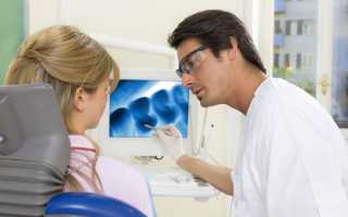 Можно ли делать рентген зуба при беременности
