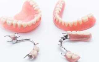 Через какое время после удаления зуба можно протезировать