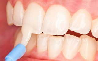 Как восстановить эмаль на зубах в домашних условиях