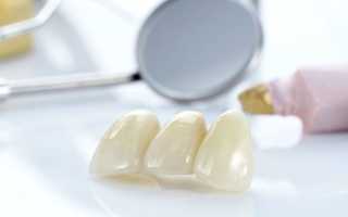 Адгезивные системы в стоматологии