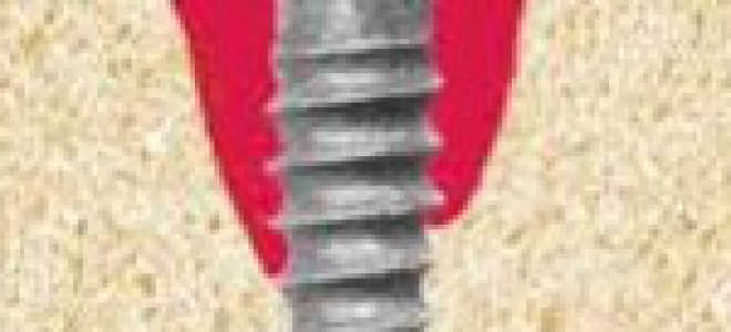 Периимплантит симптомы и лечение