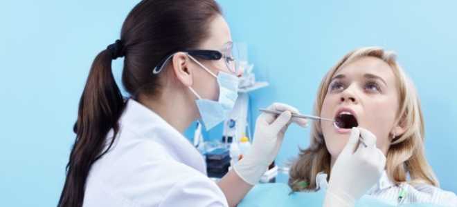 Пародонтоз как начинается