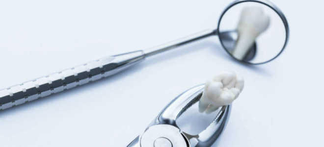 Нужно ли удалять зубы мудрости